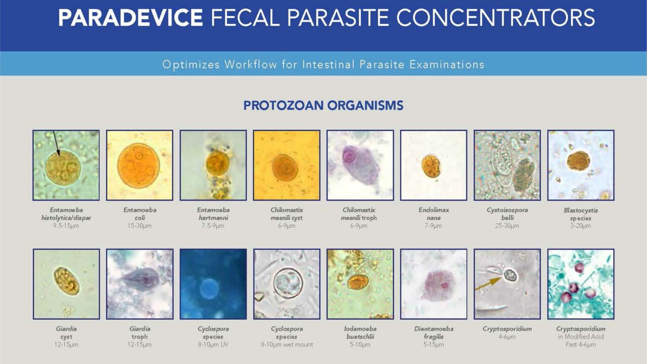 Parasitology Poster Parasitology Poster